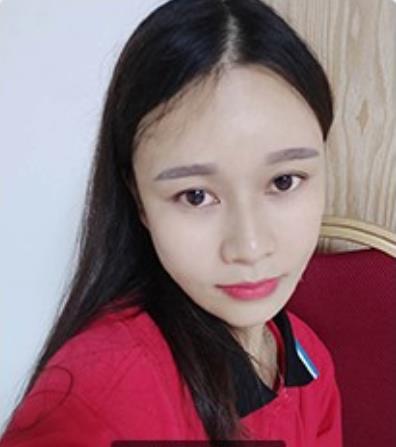 君雅筆記：眼袋過重，就會顯得比真實年齡大，要如何修復(fù)眼袋呢？