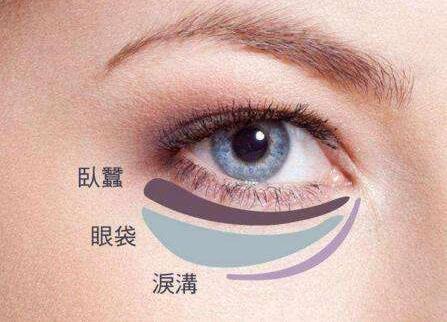 八大處整形楊欣幫你講解：眼袋祛除后過幾年還會復(fù)發(fā)嗎？