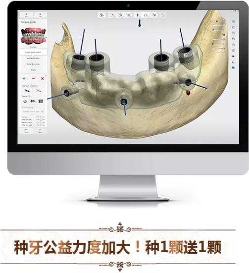 中家醫(yī)口腔全民愛牙公益行動(dòng)：德國智能種植牙更靠譜