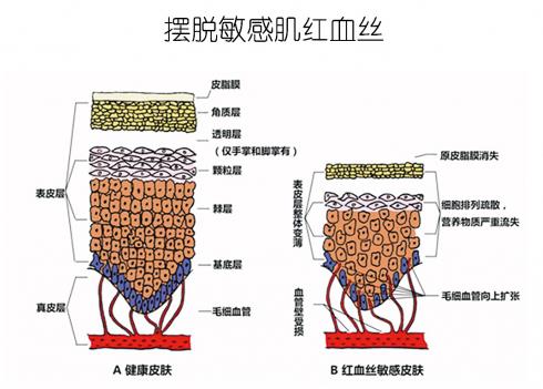 放心！有美薏升修復(fù)敏感肌紅血絲專家產(chǎn)品在，你每天都可以美美噠