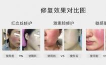 放心！有美薏升修復(fù)敏感肌紅血絲專(zhuān)家產(chǎn)品在，你每天都可以美美噠
